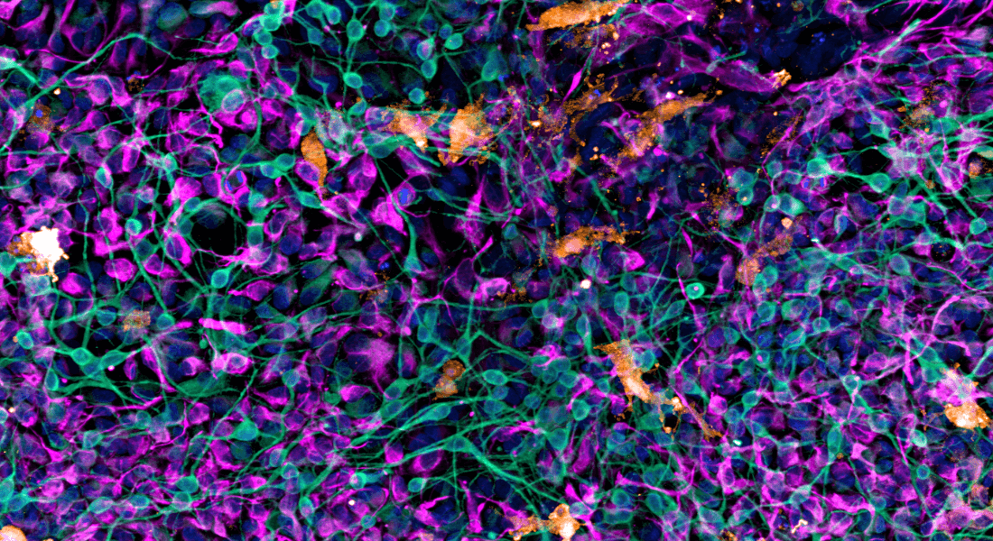 Triculture of neurons (green) astrocytes (magenta) and microglia (orange).