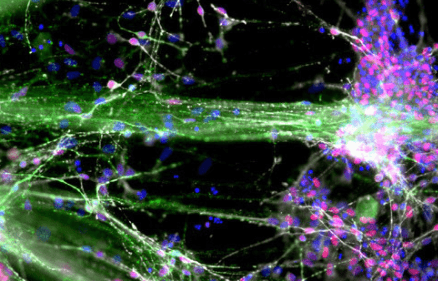 picture of dopamine producing neurons in the brain