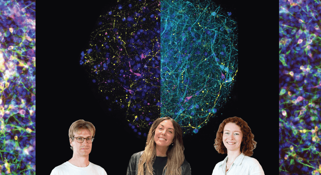 Three researchers and a brain image on background