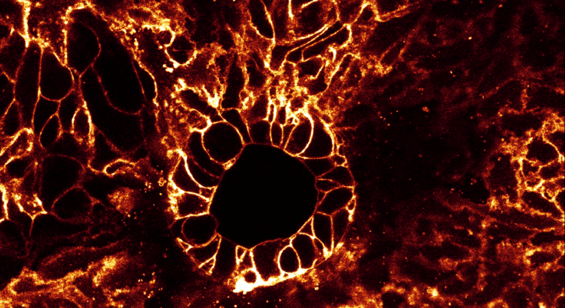 Martti stem cell image 