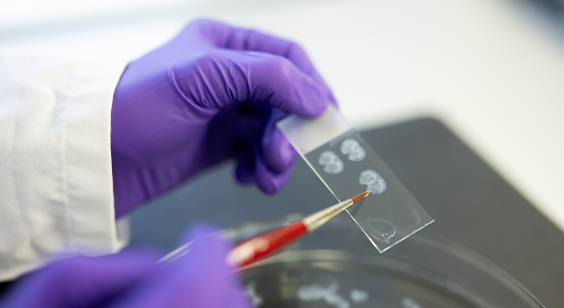 person working with rat brains in the lab with a dish